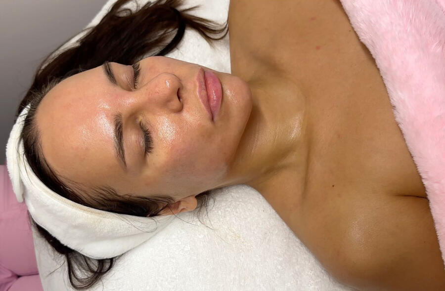 Visible Results After Customized Facial Client after customized facial treatment at Karina Skin Studio — glowing skin and radiant results